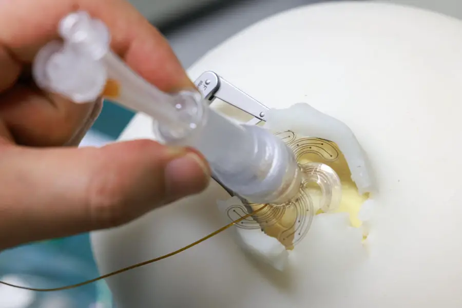 Des électrodes déployables pour une chirurgie crânienne peu invasive 4