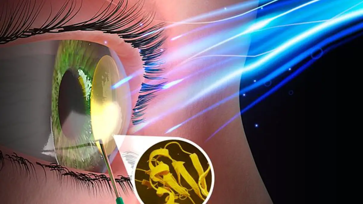 Guérir les maladies cornéennes avec un biomatériau activé par la lumière