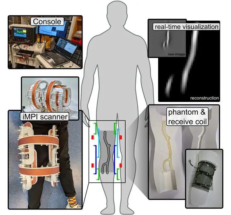 Un saut de géant dans l'imagerie médicale : le scanner iMPI 3