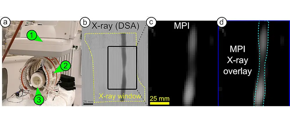 Un saut de géant dans l'imagerie médicale : le scanner iMPI 2