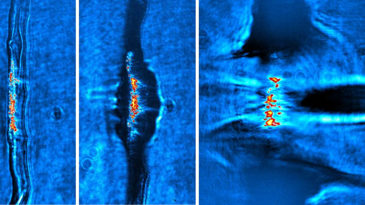 Accélération des protons par impulsions laser : une percée médicale en vue ?