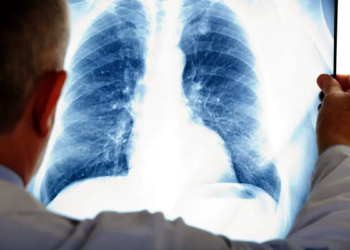 L'âge révélé par radiographie atteint une précision record
