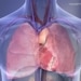 Un pacemaker expérimental capable de recharger partiellement sa batterie
