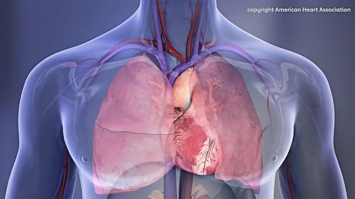 Un pacemaker expérimental capable de recharger partiellement sa batterie