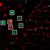L'imagerie à super-résolution, une nouvelle perspective pour la biologie et la médecine