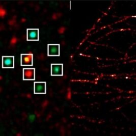 L'imagerie à super-résolution, une nouvelle perspective pour la biologie et la médecine