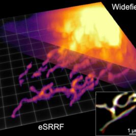 Une nouvelle méthode de microscopie offre une clarté et une précision sans précédent