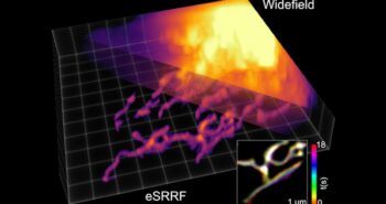 Une nouvelle méthode de microscopie offre une clarté et une précision sans précédent