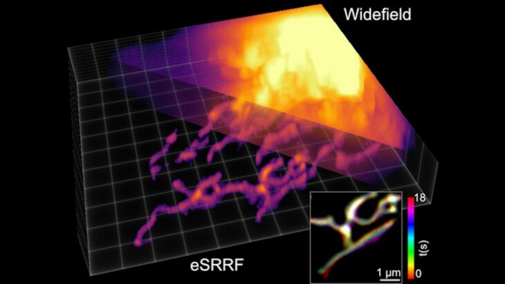 Une nouvelle méthode de microscopie offre une clarté et une précision sans précédent