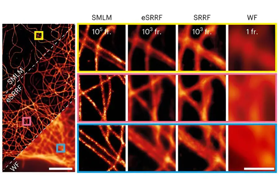 Une nouvelle méthode de microscopie offre une clarté et une précision sans précédent 2