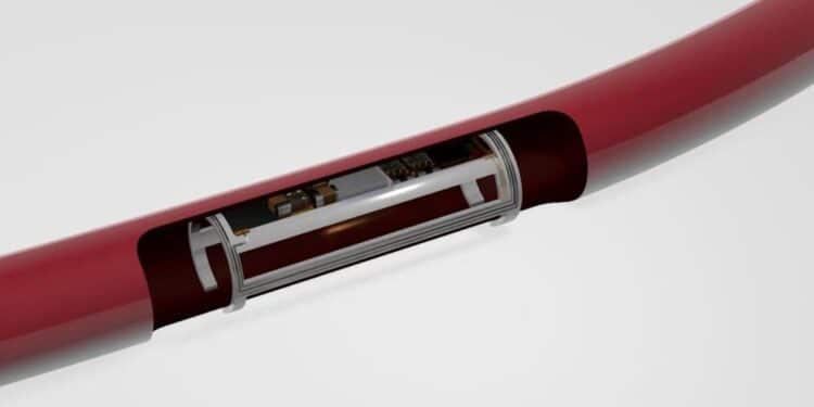 Un implant multisensoriel pour prévenir les crises cardiaques