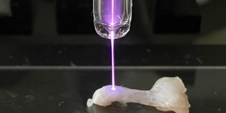 Et si le plasma d'hélium était la solution pour les blessures sportives ?