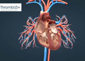 Un brassard high-tech pour déjouer le tueur cardiovasculaire invisible