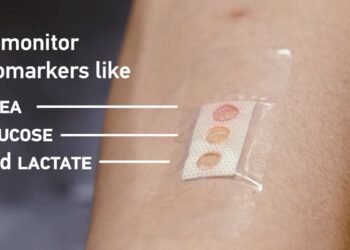 Un dispositif microlaser mesure avec précision les niveaux de glucose dans la sueur