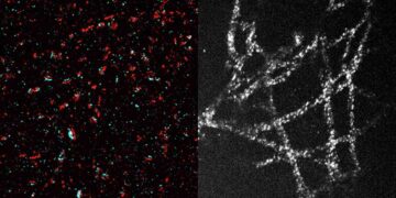 L'innovation du MIT rend accessible l'observation des composants cellulaires