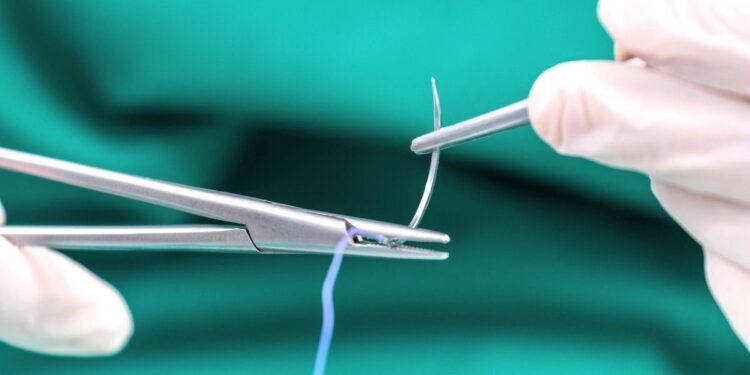 Les chercheurs chinois créent des sutures électriques pour accélérer la guérison