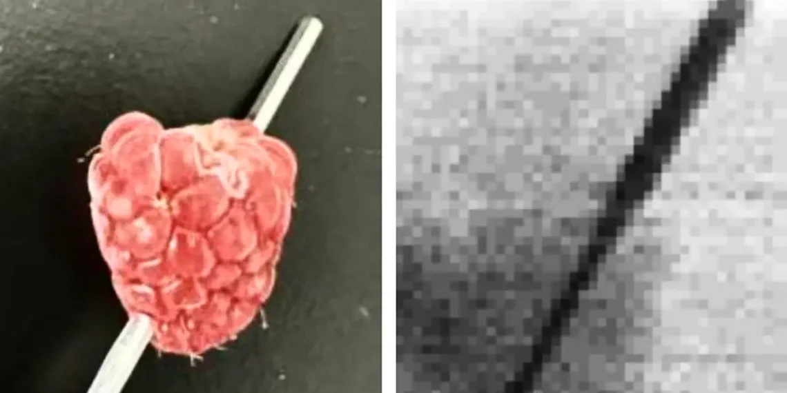 Des rayons X plus sûrs : une avancée considérable dans l'imagerie médicale moderne