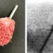Des rayons X plus sûrs : une avancée considérable dans l'imagerie médicale moderne