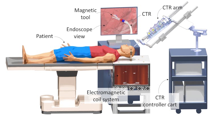 Diagram showing a patient lying on a table undergoing brain surgery.
