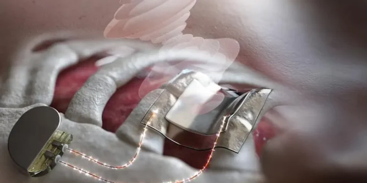 Mise au point d'une technologie de chargement de batterie sans fil par ultrasons