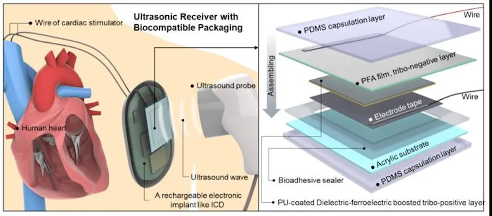 (A gauche) Application proposée d'un récepteur ultrasonique triboélectrique dans un dispositif médical implantable. (A droite) Schéma fonctionnel complet de l'appareil