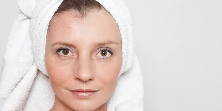 Les bienfaits des peptides de collagène : entre science et tendance