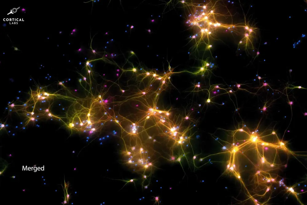Vue microscopique de neurones cultivés par Cortical Labs