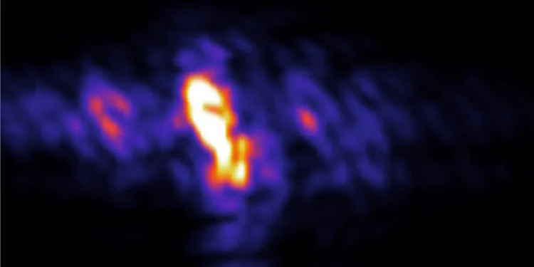 Un laser atomique à rayons X ouvre la voie à l'imagerie attoseconde