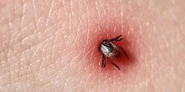Un antibiotique familier offre un nouvel espoir face à la maladie de Lyme