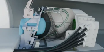 Un nouveau casque à ultrasons permet la stimulation cérébrale profonde chez les personnes sans intervention chirurgicale