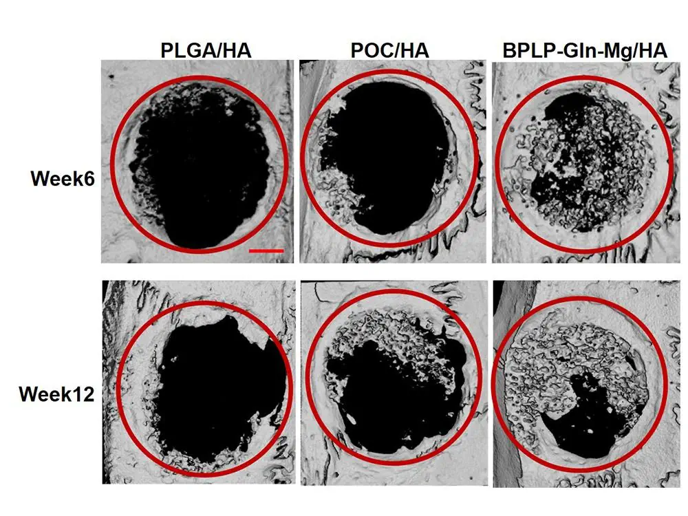 Les chercheurs ont constaté qu'après 12 semaines, l'implant CitraBoneQMg (colonne de droite) avait augmenté la croissance osseuse autour de la lésion crânienne des rats de 56 % par rapport aux rats ayant reçu l'échafaudage à base d'acide citrique uniquement (colonne du milieu), et de 185 % par rapport aux rats ayant reçu un implant en matériau osseux traditionnel (colonne de gauche)