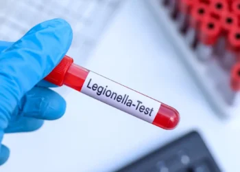 Flambée de légionellose à Albertville : l’eau suspectée, les habitants inquiets