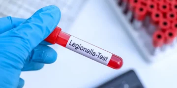 Flambée de légionellose à Albertville : l’eau suspectée, les habitants inquiets