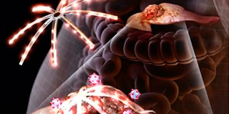 Des micro-LED 3D inspirées de la pieuvre ouvrent la voie à une thérapie sélective du cancer du pancréas