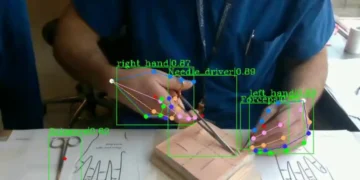 Face à une pénurie de chirurgiens de plus en plus grave, l'intelligence artificielle pourrait contribuer à combler ce manque en formant les étudiants en médecine.