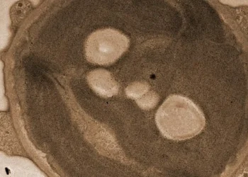 Electron microscope image of algae pre-treated with espresso to create stronger contrasts.