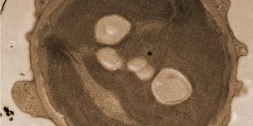 Electron microscope image of algae pre-treated with espresso to create stronger contrasts.