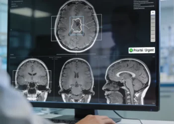 Un modèle d'IA peut lire et diagnostiquer une IRM cérébrale en quelques secondes