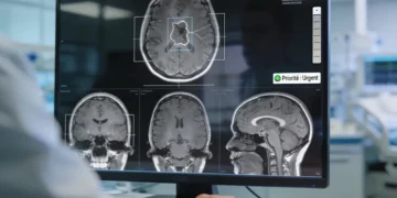 Un modèle d'IA peut lire et diagnostiquer une IRM cérébrale en quelques secondes