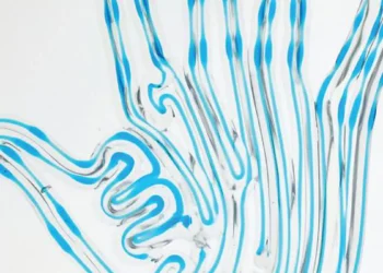 A 3D printed hand, with hinges, before perfusion. 