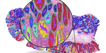 Image complète illustrant la détection de structures histologiques clés telles que les glandes et les cellules. Crédit : Dr Fayyaz Minhas / Université de Warwick