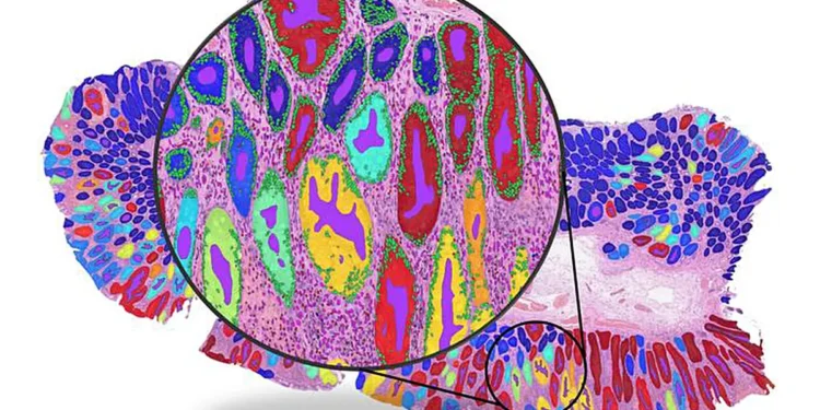 Image complète illustrant la détection de structures histologiques clés telles que les glandes et les cellules. Crédit : Dr Fayyaz Minhas / Université de Warwick