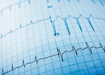 Quand l'IA lit les ECG pour prédire la mort subite cardiaque