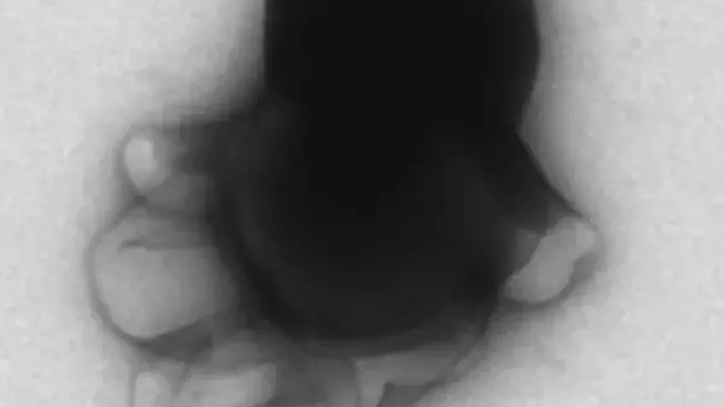 L'un des nanorobots, photographié à l'aide d'un microscope électronique à transmission