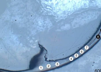 Qu'est-ce qu'un bio-métal ? Explorer le mystère métallique d'une mâchoire ancienne