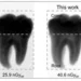 Un nouveau détecteur à pérovskite permet des images radiologiques claires à dose bien plus faible