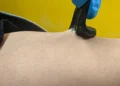 Biocapteurs souples, collants et extensibles : une meilleure connexion