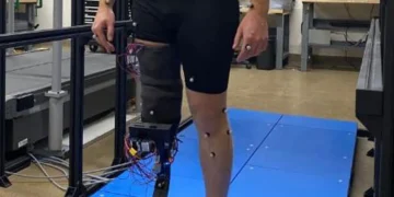 Des ingénieurs créent une solution portable pour optimiser l'ajustement et le confort des prothèses