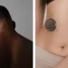 Coherence teste un implant cérébral contre les tumeurs
